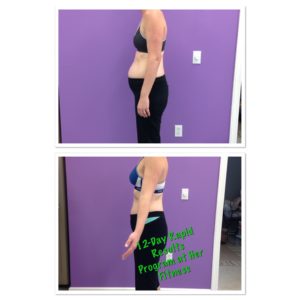 12-Day Rapid Results Before & After